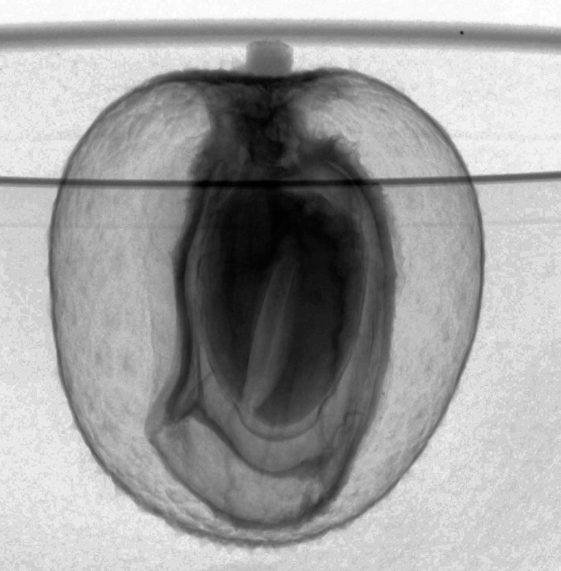 Lychee: X-ray projection